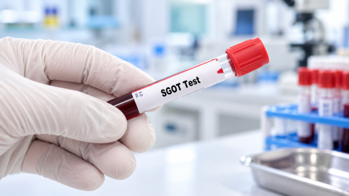 SGOT SGPT Tinggi: Apa Artinya dan Kapan Perlu Konsultasi Dokter?